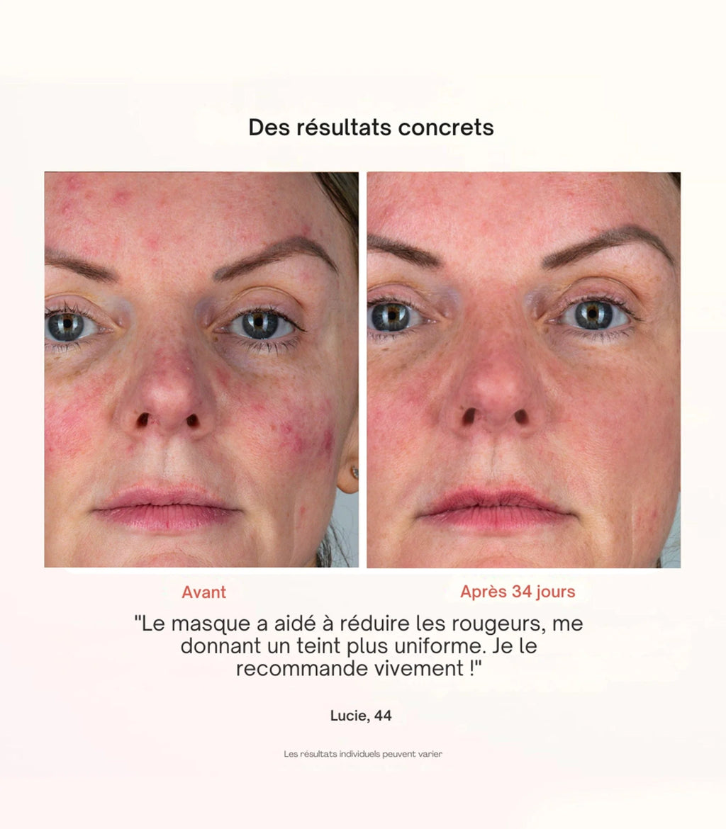 Masque LED pour le visage