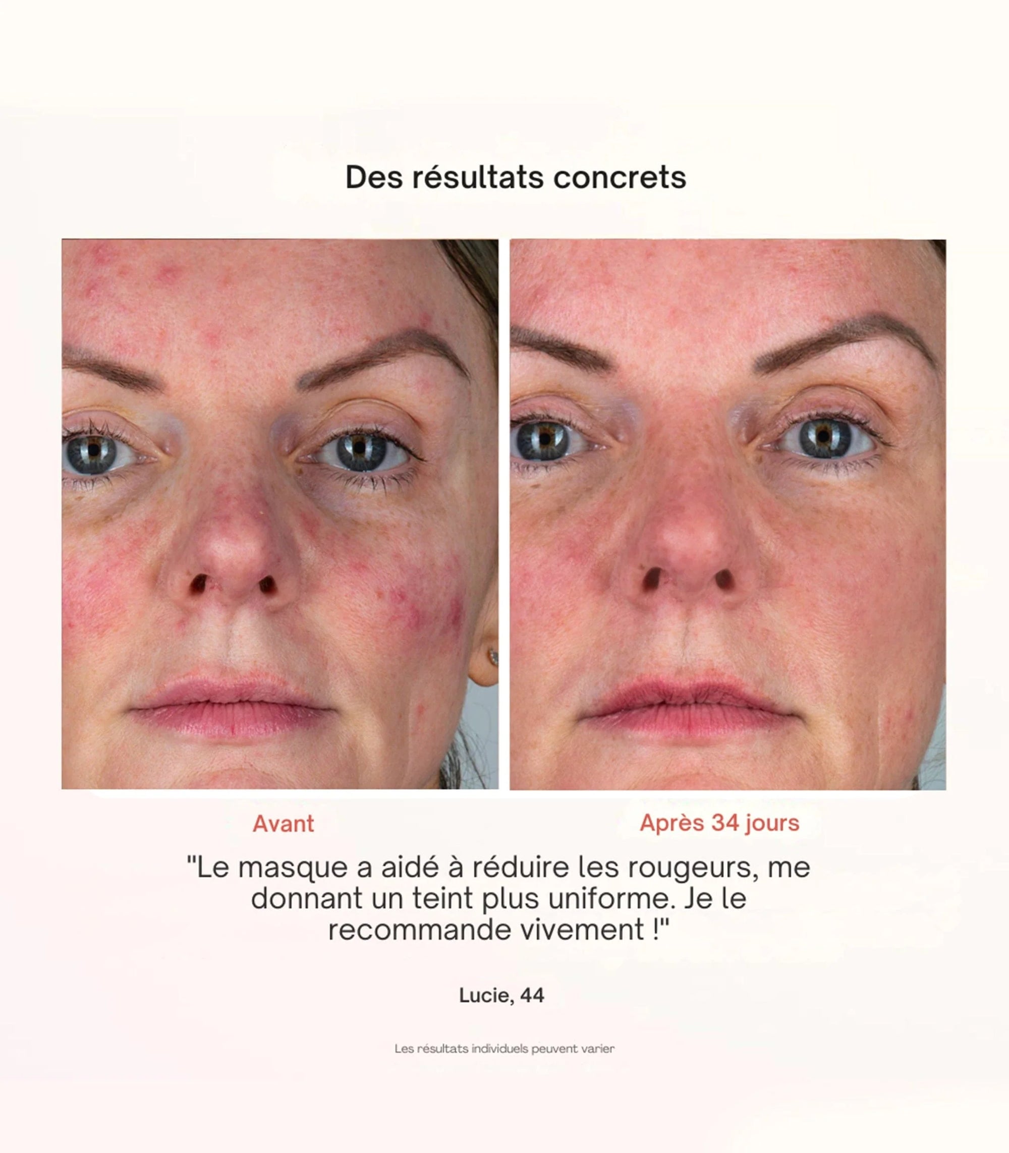 Masque LED pour le visage